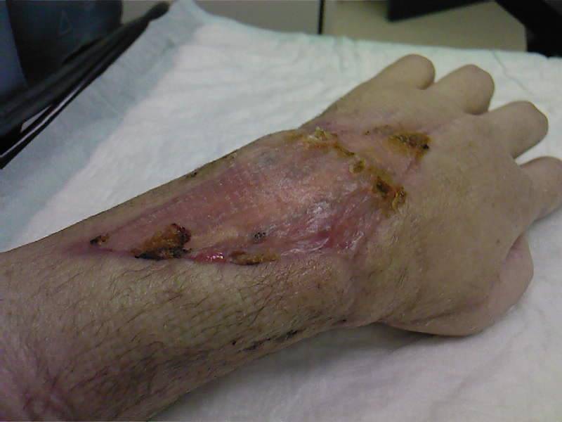 Hand